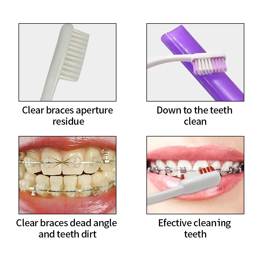 8Pcs/set Orthodontic Dental Ca - огляд і ціна Teeth Whitening With Braces