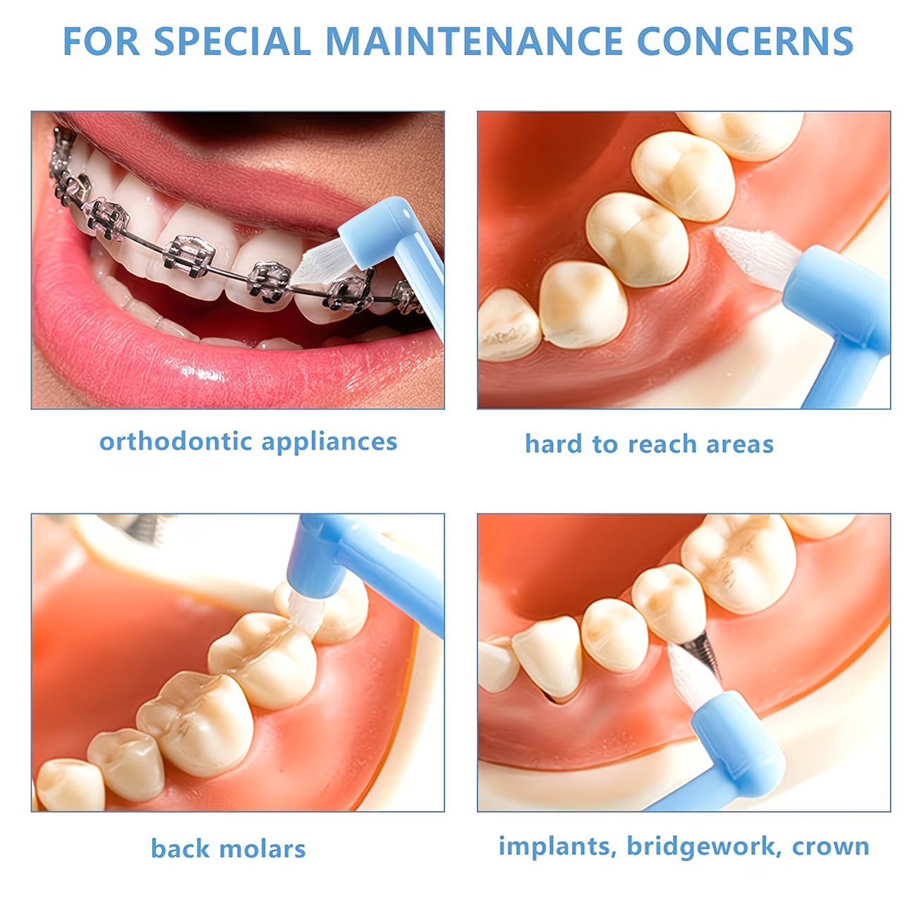 1/3pc Orthodontic Braces Tooth - огляд і ціна Teeth Whitening With Braces