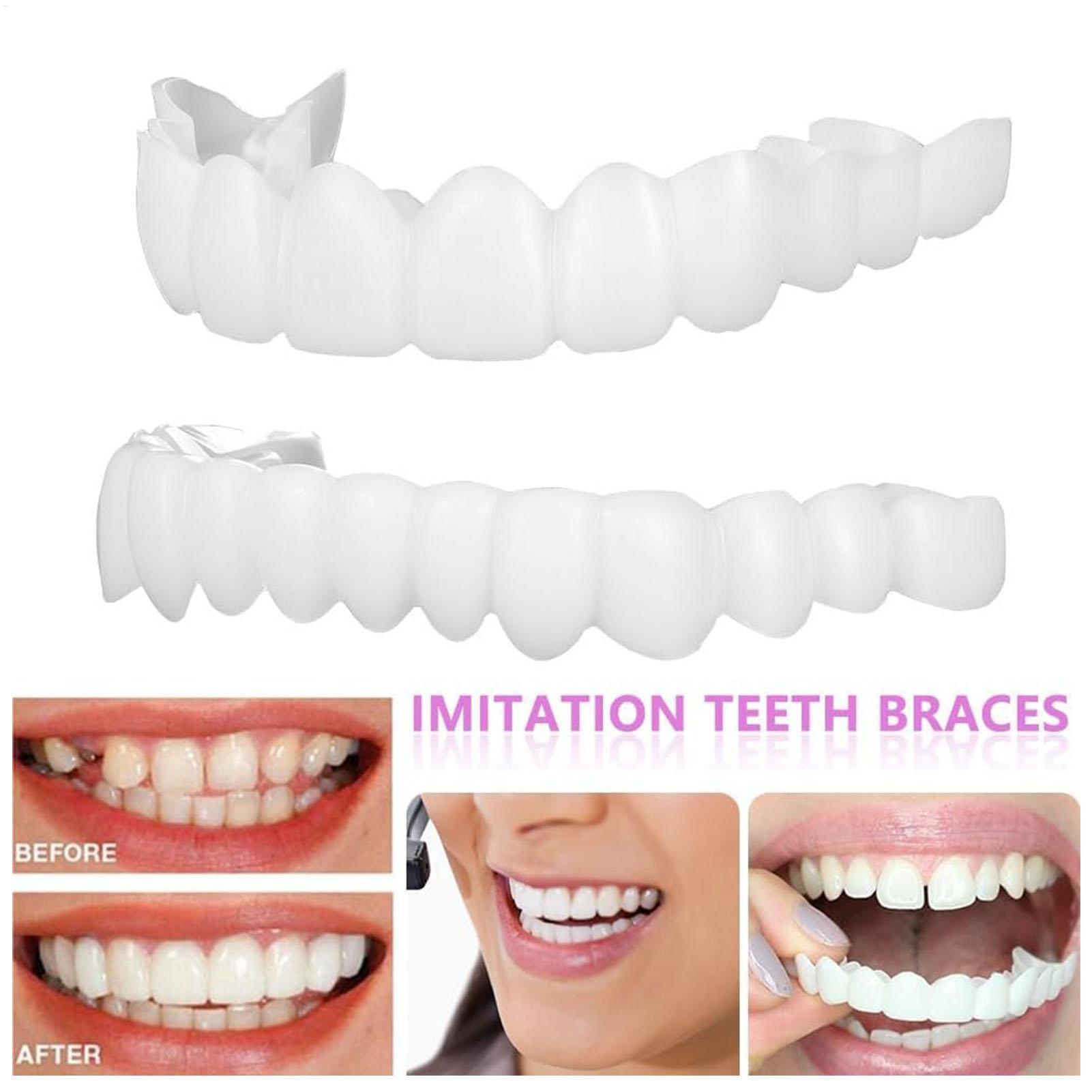 Dental Upper Lower Fake Teeth  - огляд і ціна Teeth Whitening With Braces
