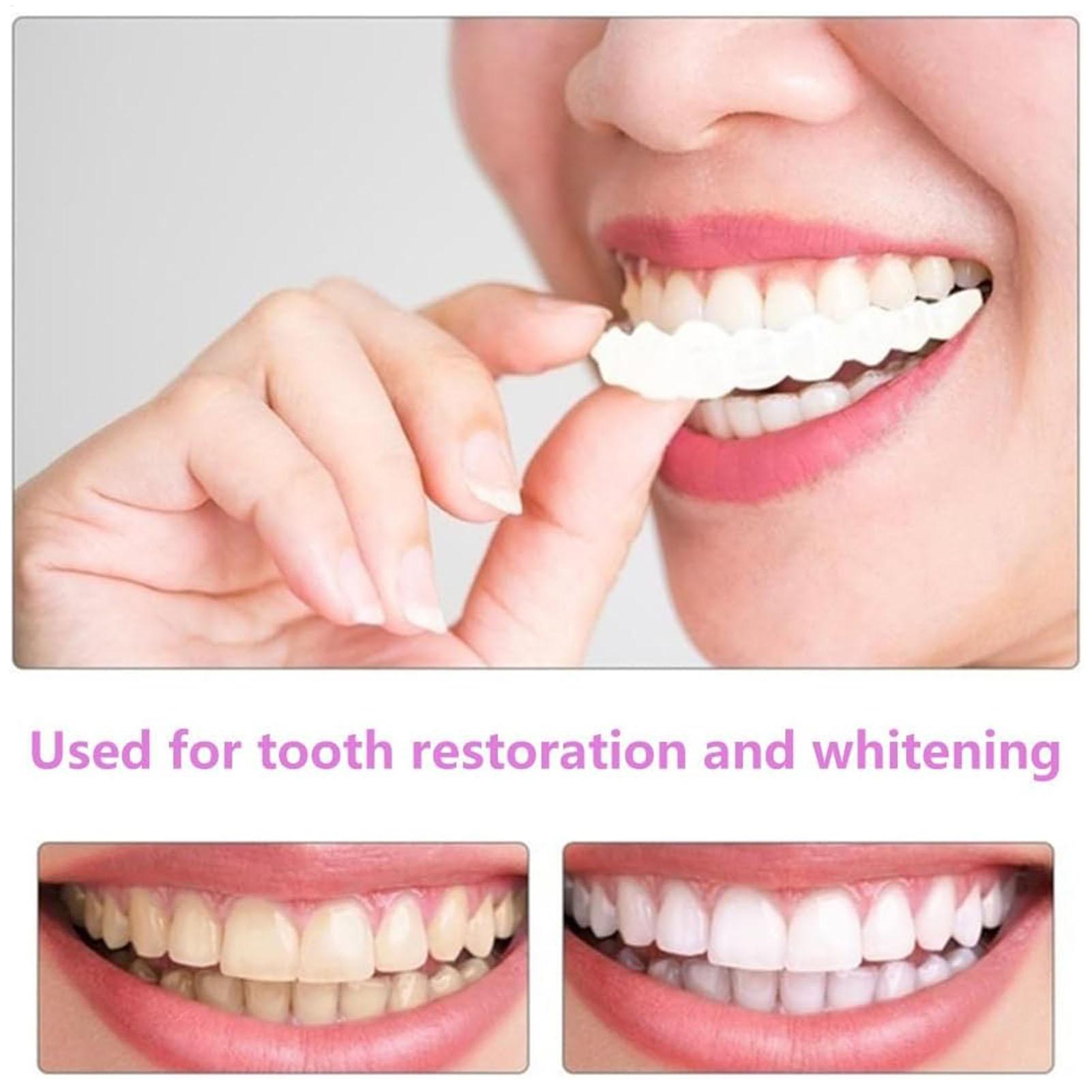 Dental Upper Lower Fake Teeth  - огляд і ціна Teeth Whitening With Braces