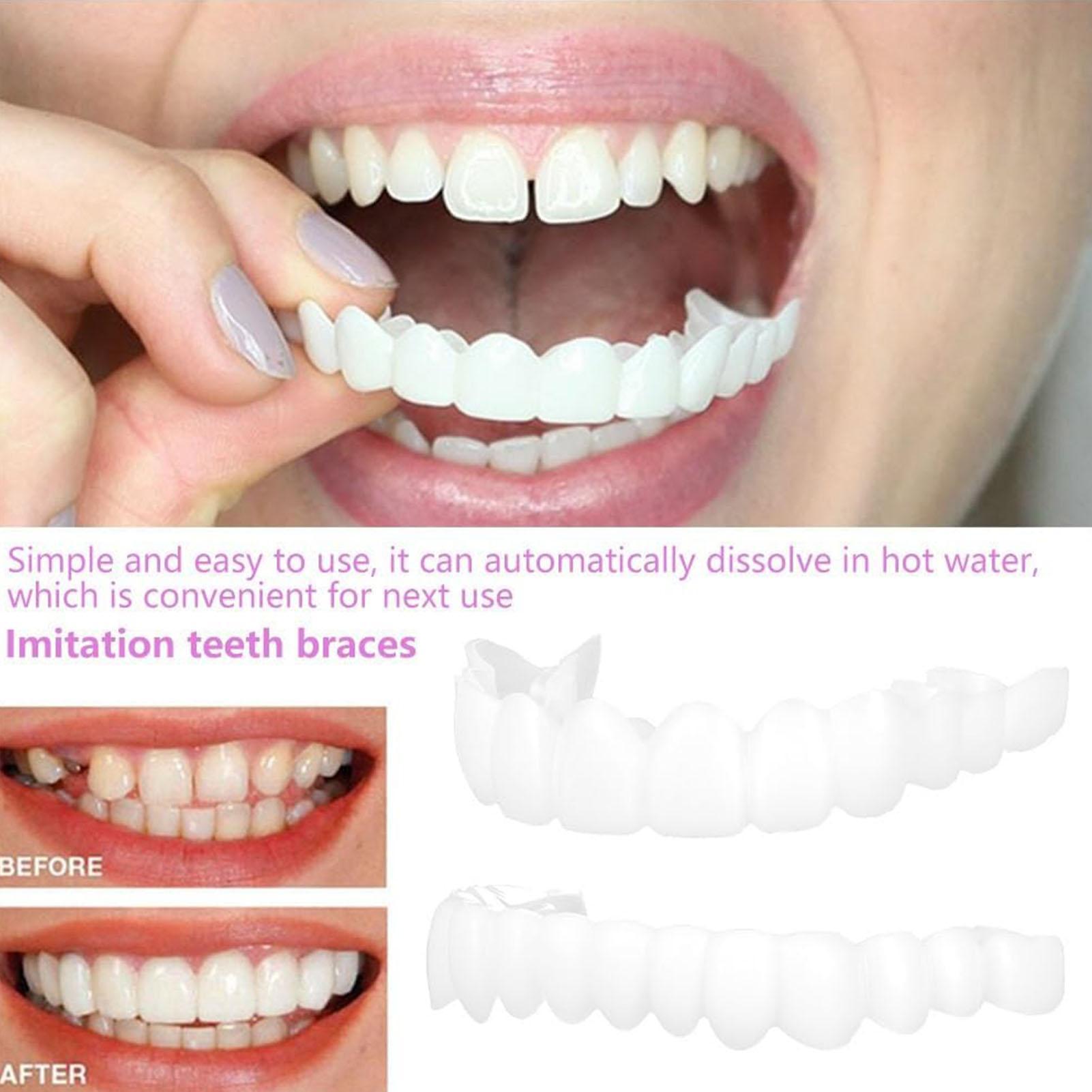 Dental Upper Lower Fake Teeth  - огляд і ціна Teeth Whitening With Braces