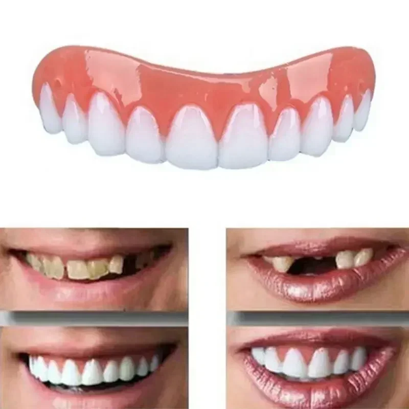 New False Teeth Silicone Upper - огляд і ціна Teeth Whitening With Braces