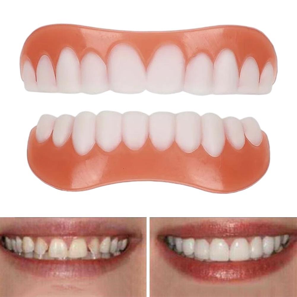 New False Teeth Silicone Upper - огляд і ціна Teeth Whitening With Braces
