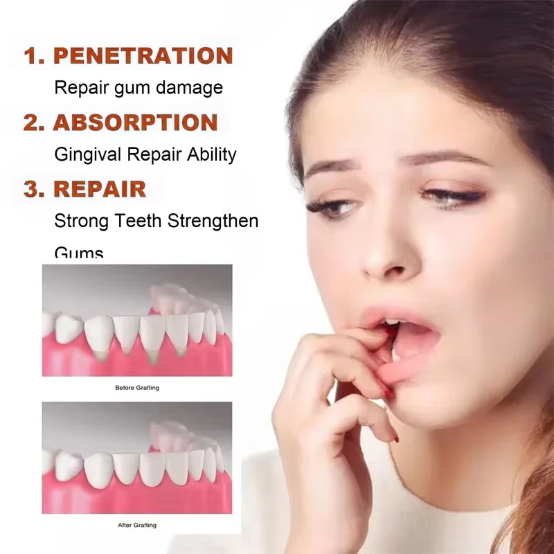 Rapid Repair Gums Serum Effect - огляд і ціна Teeth Whitening Foam