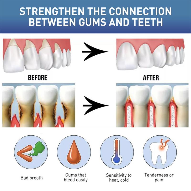 Rapid Repair Gums Serum Effect - огляд і ціна Teeth Whitening Foam
