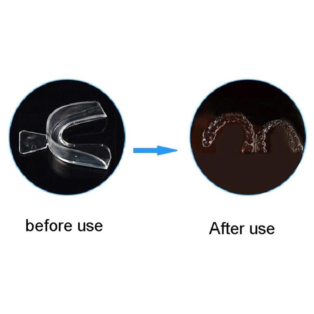 Silicone Mouth Guard Orthodont - огляд і ціна Teeth Whitening With Braces