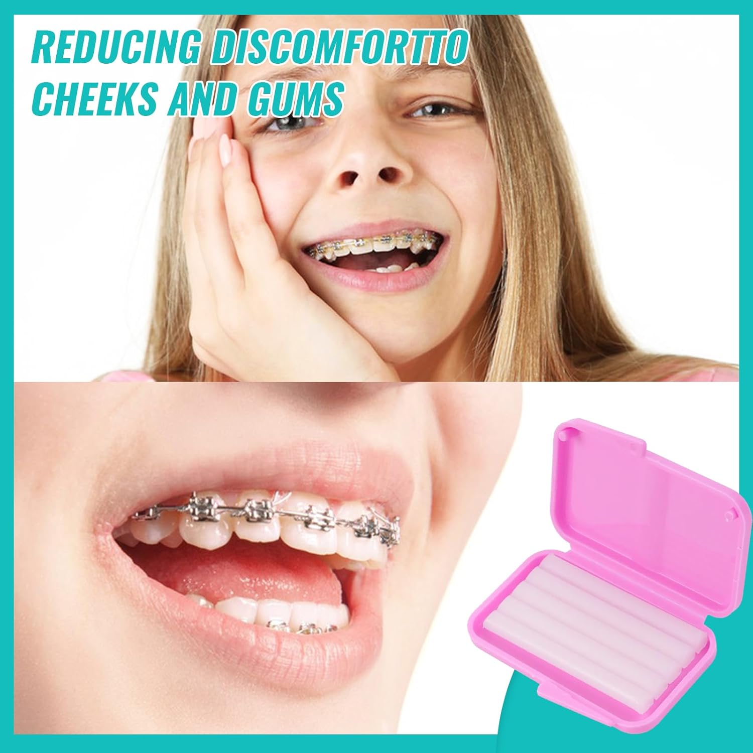 10box Dental Orthodontic Relie - огляд і ціна Teeth Whitening With Braces