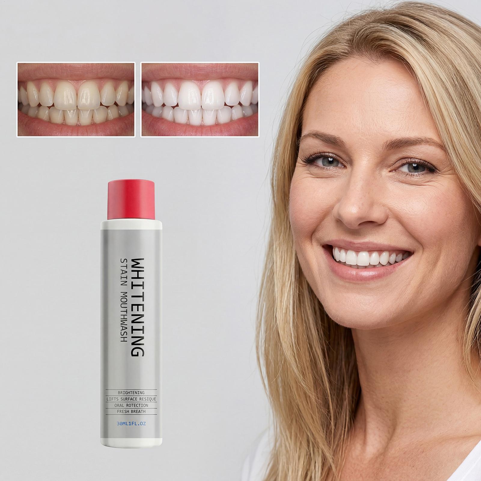 30ml Stain Whitening Mouthwash - огляд і ціна Teeth Whitening Mouthwash