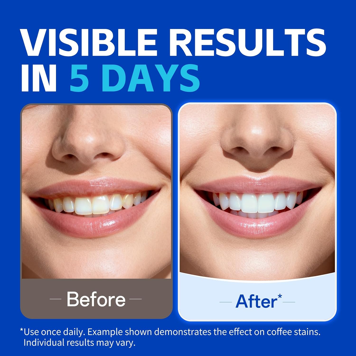 1/7 pairs Teeth Whitening Stri - огляд і ціна Teeth Whitening Strips Crest