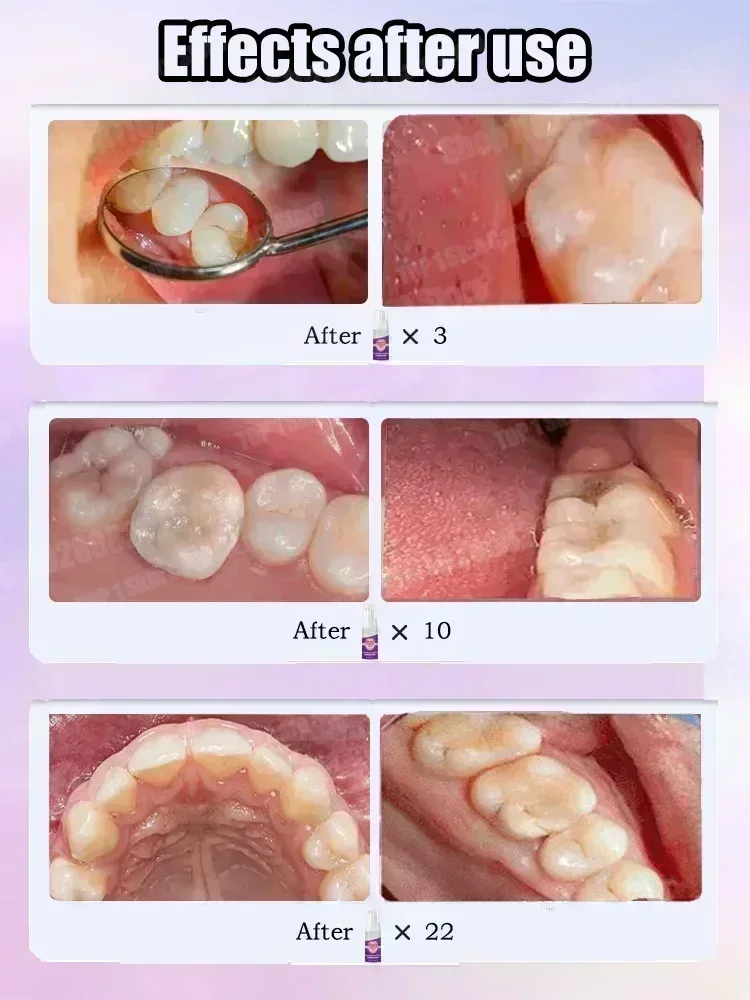 Hot sales Best-selling, Scient - огляд і ціна Teeth Whitening Foam
