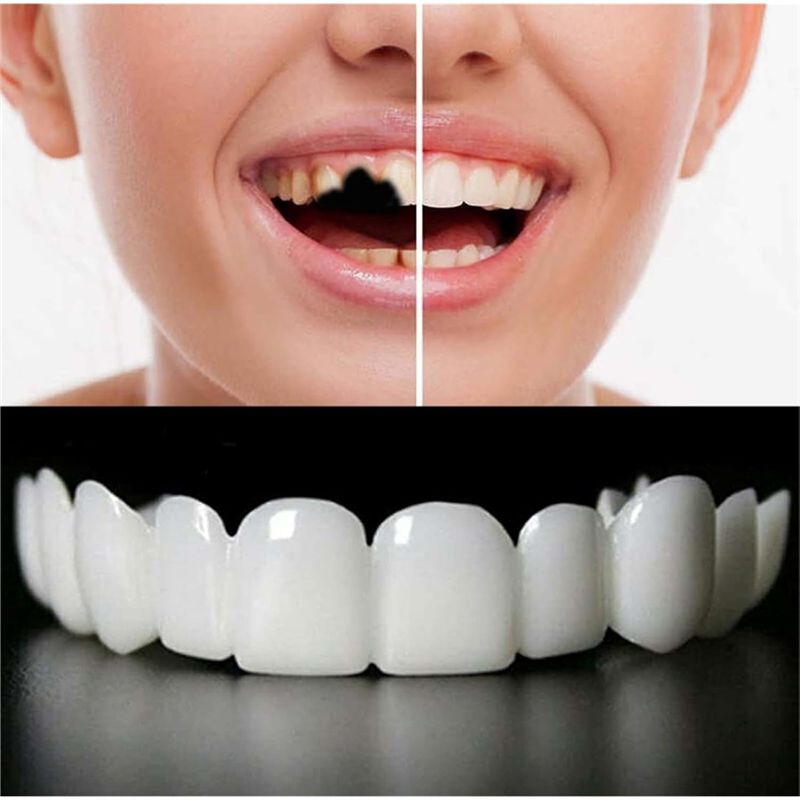 [NEW!ABMK】 2 Pairs,Regain Beau - огляд і ціна Teeth Whitening With Braces