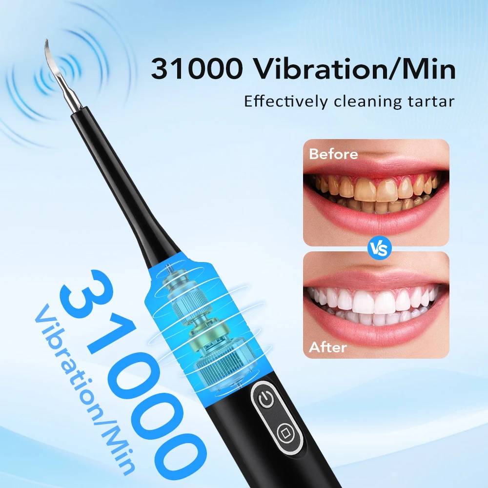Electric Sonic Vibration Denta - огляд і ціна Teeth Whitening Express