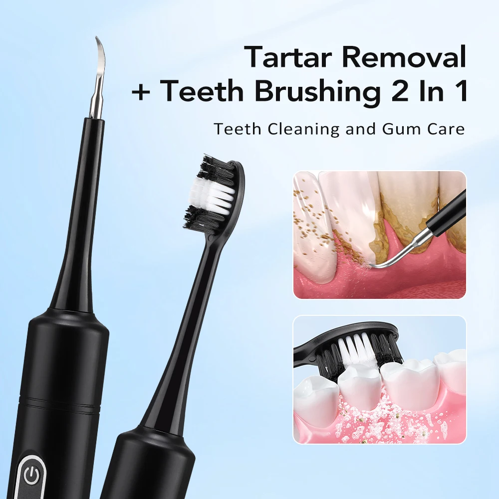 Electric Sonic Vibration Denta - огляд і ціна Teeth Whitening Express